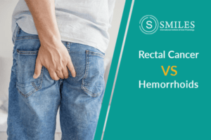 Rectal Cancer Symptoms vs Haemorrhoids Symptoms | SMILES