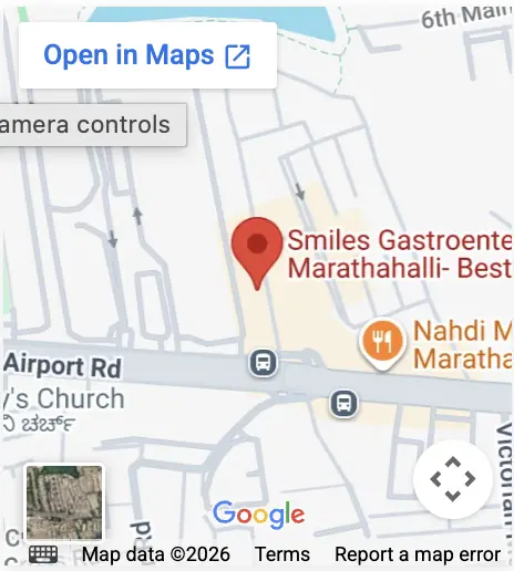 Map &mdash; Smiles Gastroenterology Marathahalli