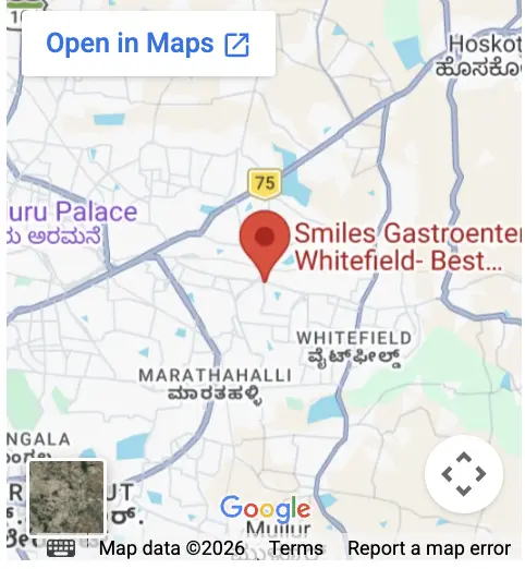 Map &mdash; Smiles Gastroenterology Whitefield
